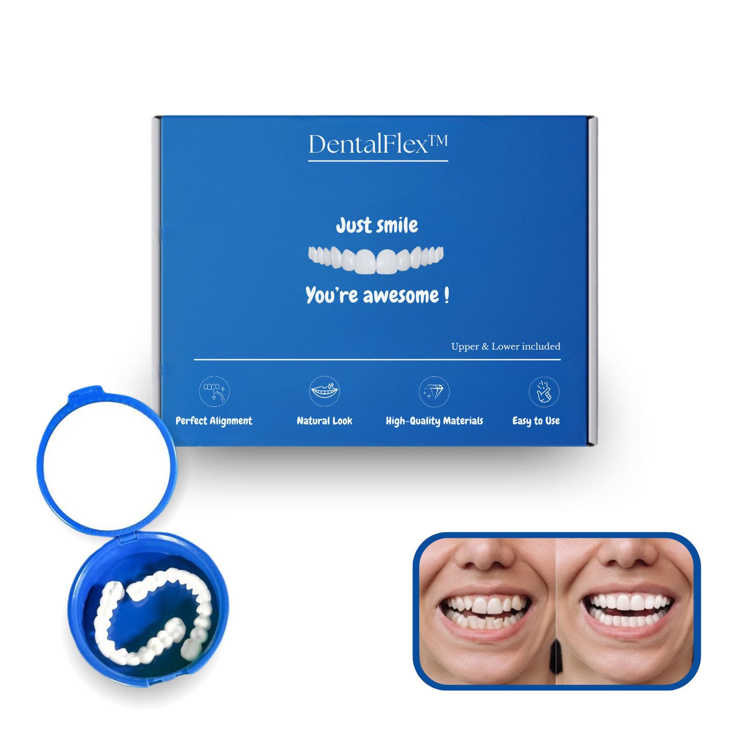 DentalFlex™ | Custom Veneer Set – Top & Bottom